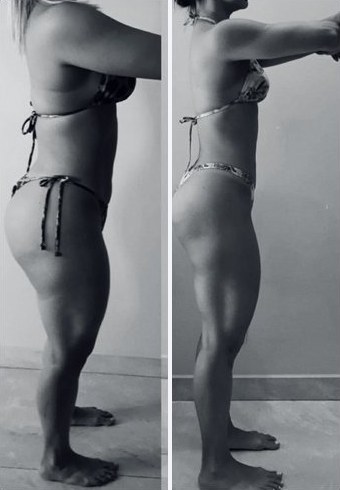 Comparativo de acompanhamento, antes e depois, em preto e branco