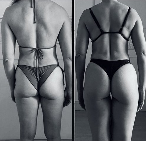 Comparativo de acompanhamento, antes e depois, em preto e branco
