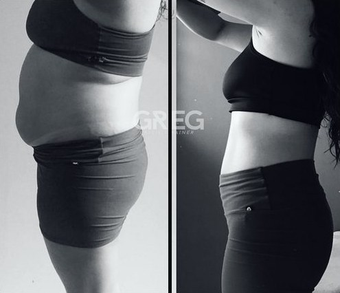 Comparativo de acompanhamento, antes e depois, em preto e branco