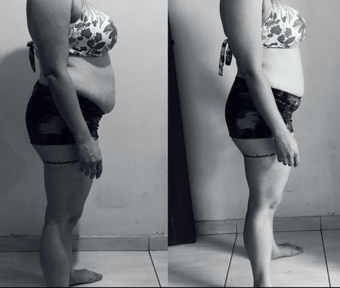 Comparativo de acompanhamento, antes e depois, em preto e branco